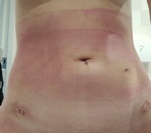 Lana Life Lately – after surgery!